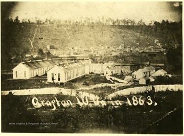 1863 US Army hospital at Grafton WV . Photo procured from the Library of Congress 